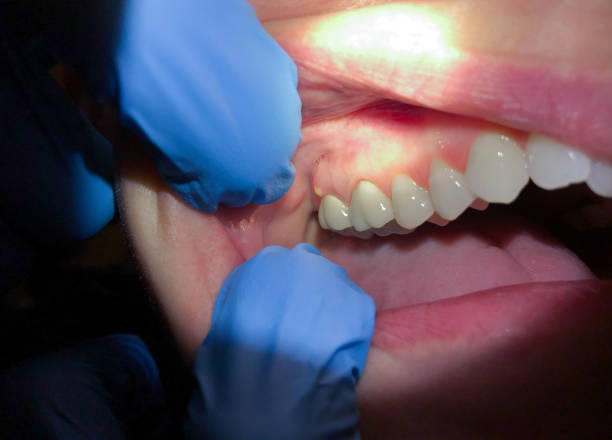 Best Emergency TMJ Treatment in Brewster Hill, NY